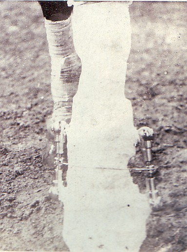 Datei:Schönrath Wund-orthopädische Versorgung Bild 4.jpg